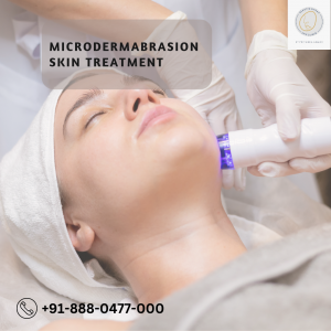 Unravel Radiant Skin: Book Your Appointment for the Best Microdermabrasion and Skin Acne Treatments in Delhi